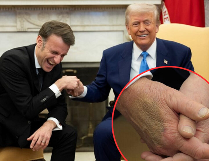 Čudne mrlje na ruci D. Trump-a?